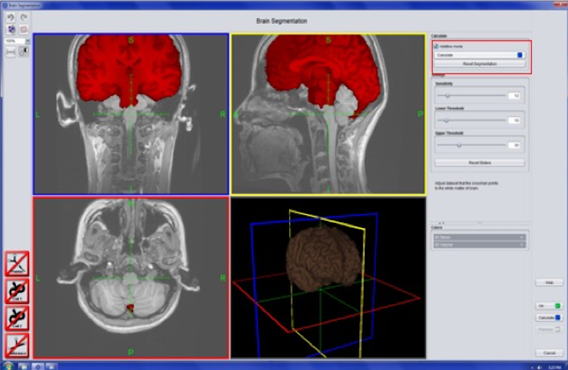 ../_images/TMS_BrainSegmentation.png