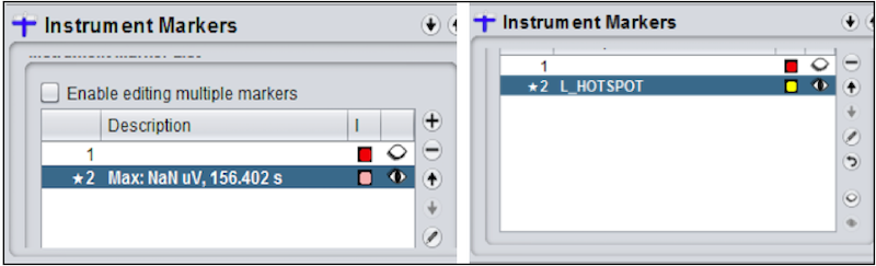 ../_images/TMS_InstrumentMarkers-ControlPanel.png