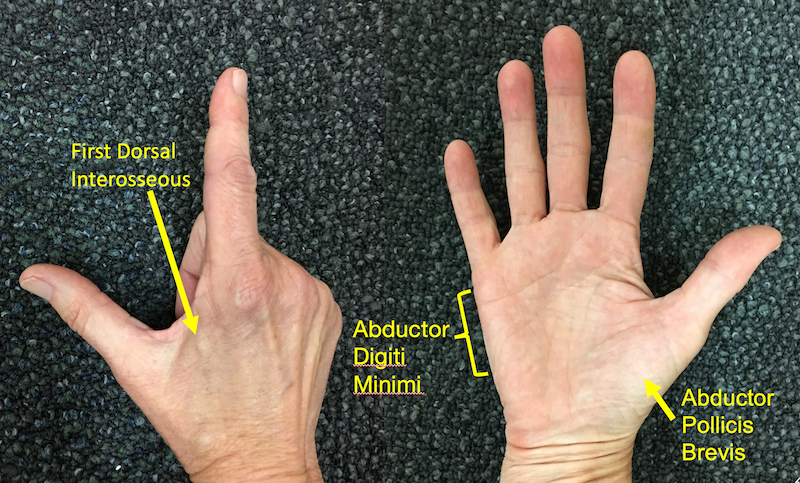 ../_images/TMS_hand_muscles.png