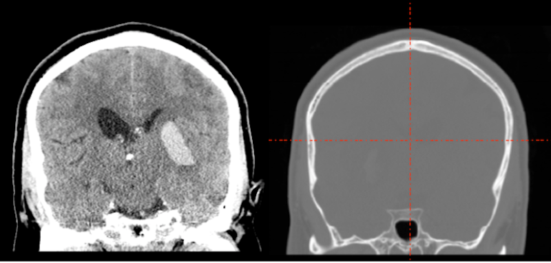 CT image contrast in the original dicom image is good (left). Once converted to NIFTI, the contrast is extremely poor (right).