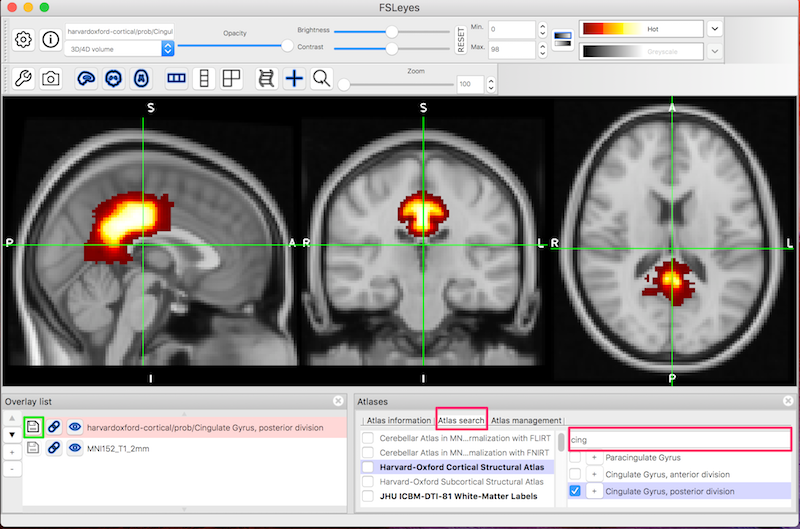 Loading the cingulate roi from the Harvard Oxford cortical atlas