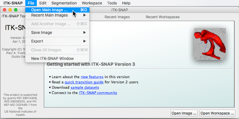 itksnap interface: File->open main image