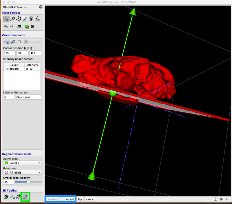 The scalpel tool is available from the 3D toolbar on the bottom left of the itksnap interface (green rectangle). The scalpel display is a plane that can be placed on the 3D reconstruction. Press "accept" (blue rectangle bottom of interface) to slice off part of the 3D shape. Note that the green arrow points toward the portion of the 3D shape you want to keep. The segmentation label is set to green and label 2.